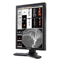 Highly-accurate medical diagnostic displays 2MP MD21C