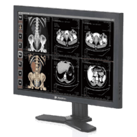 Top-selling diagnostic radiology monitors witth stable brightness MD23C