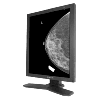 High-precision 5MP medical monitor for mammography