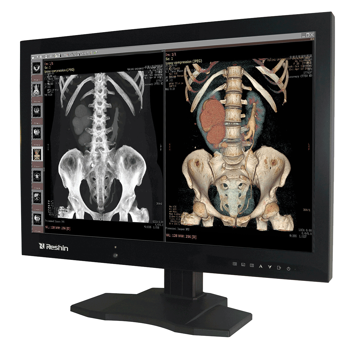 Fast-delivery radiology MD61C medical computer monitor