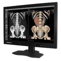 Fast-delivery radiology MD61C medical computer monitor