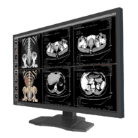 Professional custom diagnostic display medical MD83C