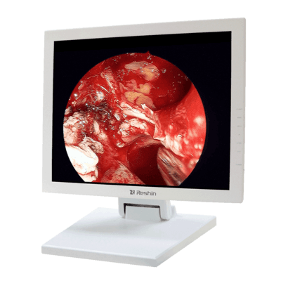 ENT lcd dicom compatible monitor ms156s