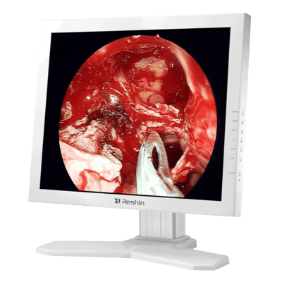 White high-resolution 19 inch surgical monitor for operation