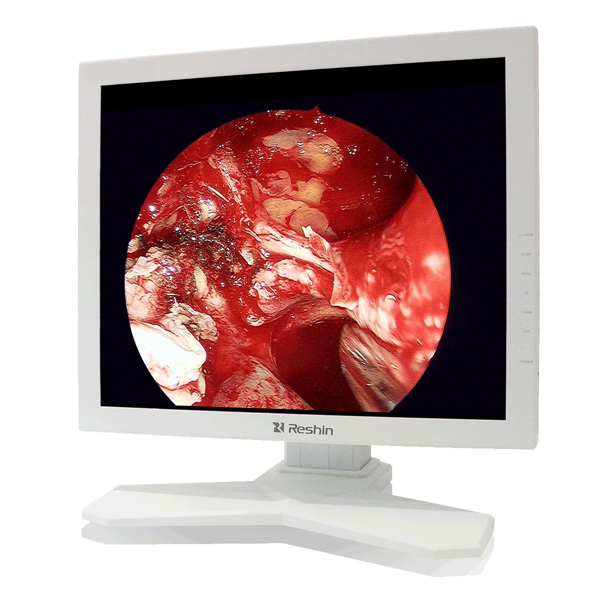 Full-interface 19 inch hospital led monitor with top IPS medical panel