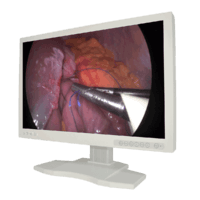 Bright and clear lcd medical monitor free from dust