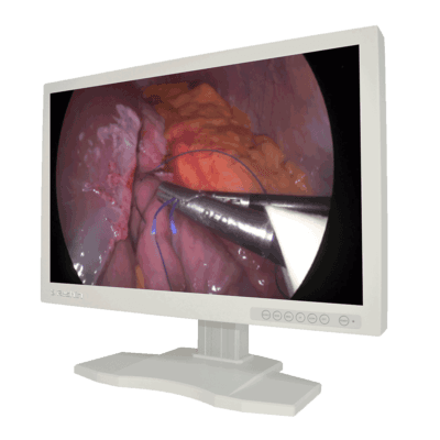 Bright and clear lcd medical monitor free from dust